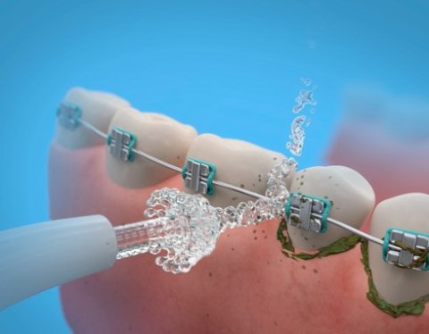 LD-A8 Irygator jamy ustnej ŻÓŁTY